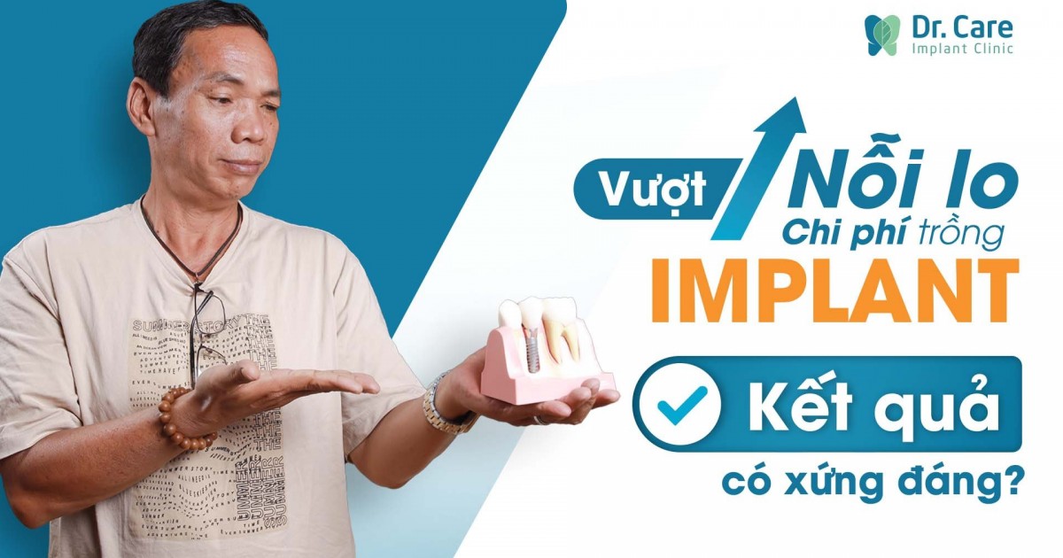 VƯỢT NỖI LO CHI PHÍ TRỒNG IMPLANT - KẾT QUẢ NHẬN ĐƯỢC CÓ XỨNG ĐÁNG?