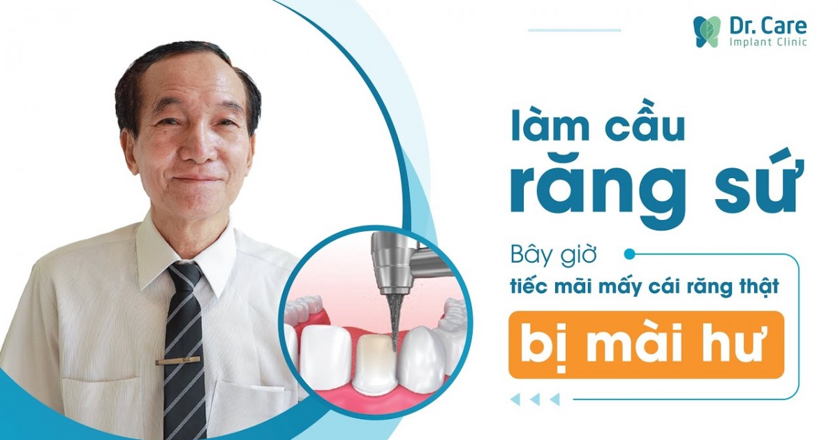2 LẦN LÀM CẦU RĂNG SỨ - CHÚ TIẾC QUÁ MẤY CÁI RĂNG THẬT BỊ MÀI HƯ