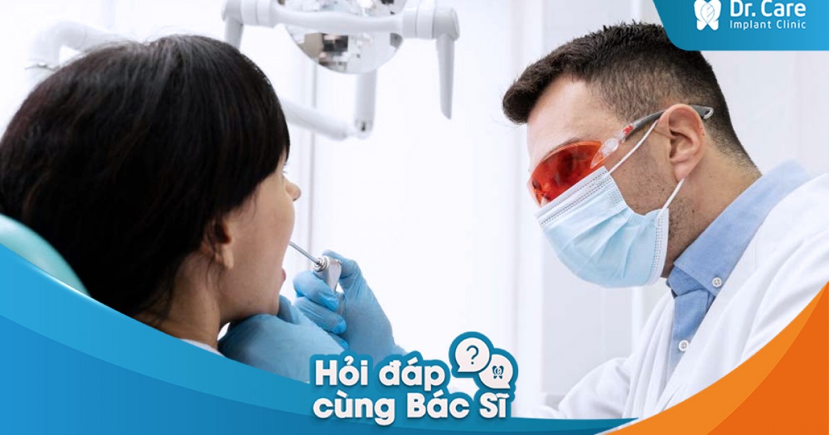 Để thực hiện hoàn tất quy trình trồng răng Implant cần bao lâu, có phải chia thành nhiều buổi không?