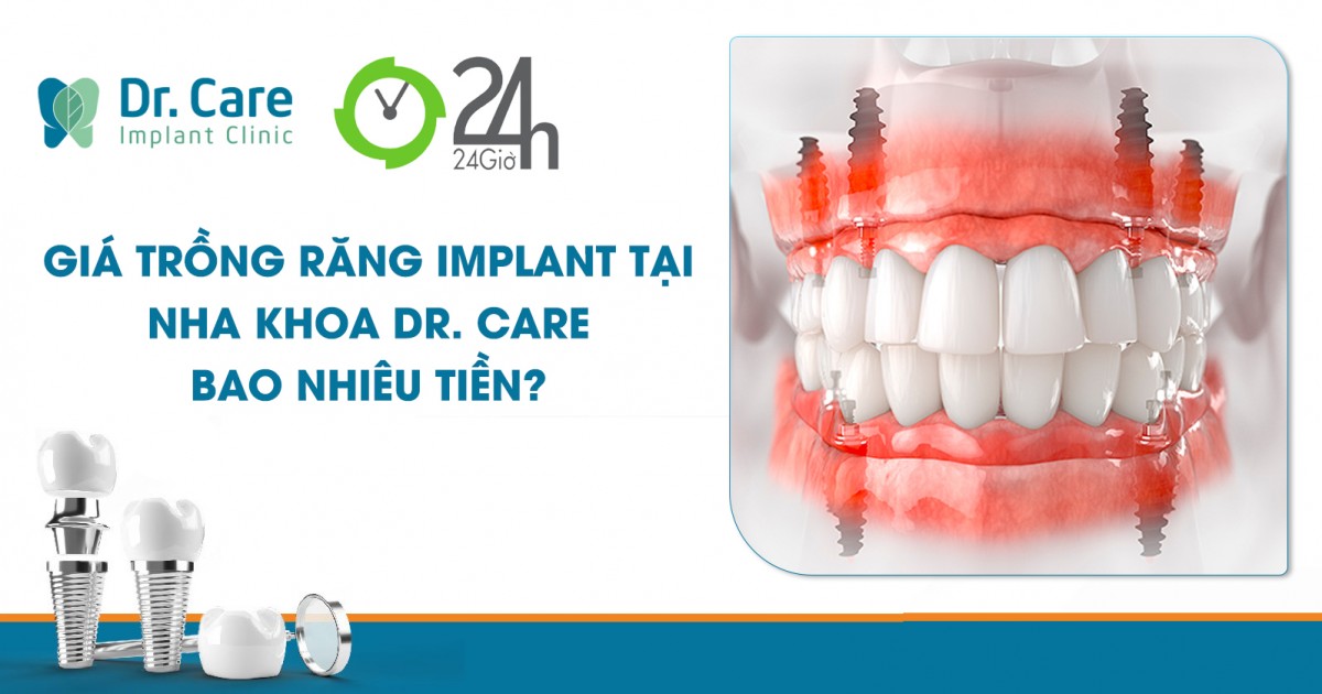 Báo 24h - Tìm hiểu về chi phí làm răng tại nha khoa trồng răng không đau - Dr. Care Implant Clinic