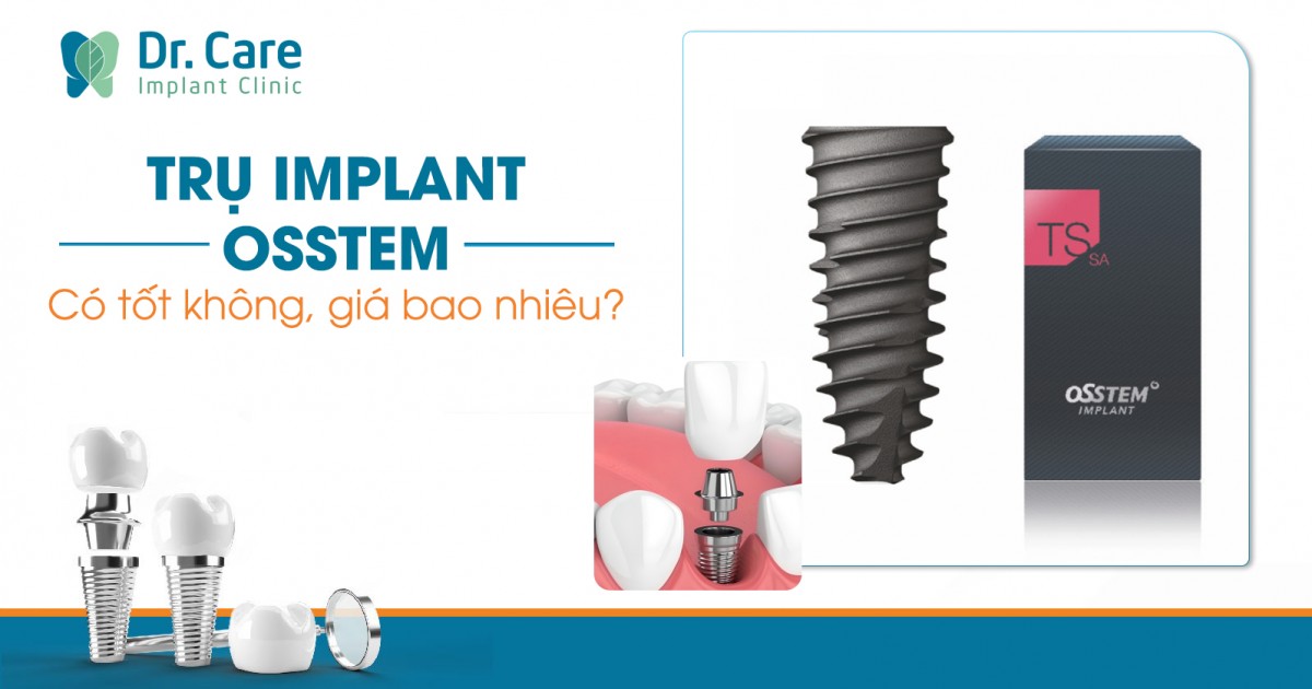 Trụ Implant Osstem Hàn Quốc - Tìm hiểu xuất xứ, ưu điểm và giá cả