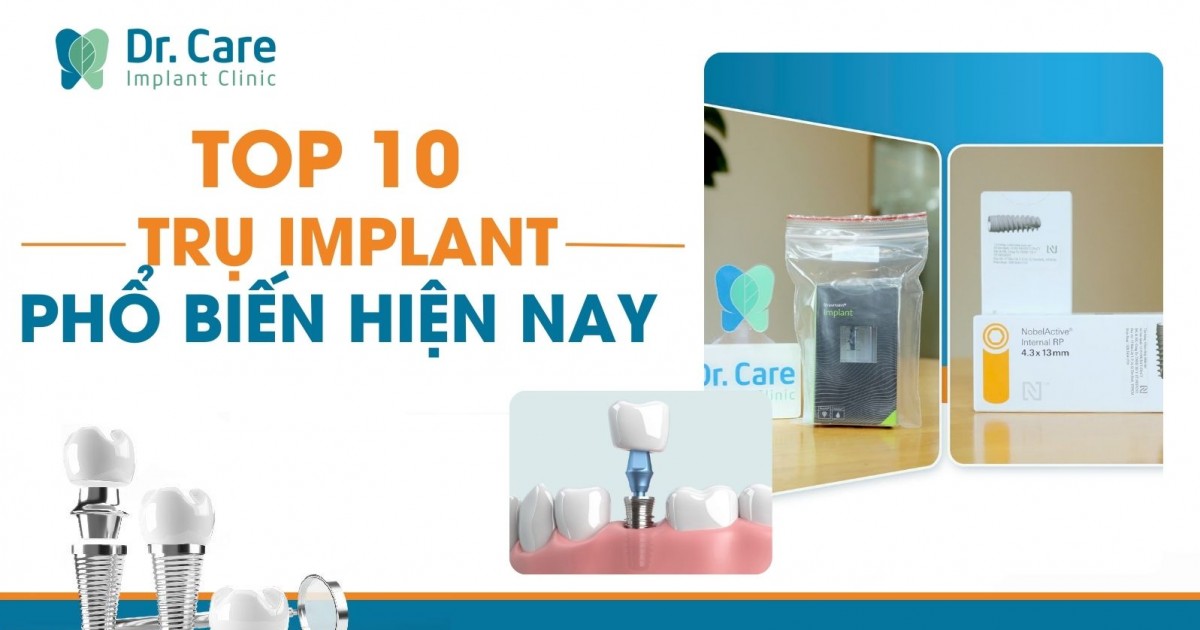Top 10 dòng trụ Implant phổ biến nhất hiện nay