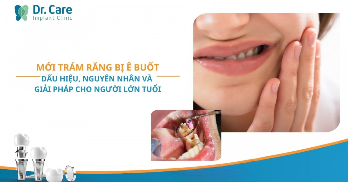 Mới trám răng bị ê buốt – Dấu hiệu, nguyên nhân và giải pháp cho người lớn tuổi