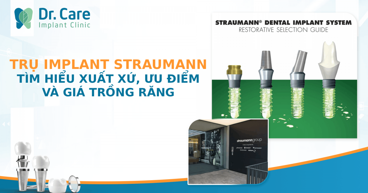 Trụ Implant Straumann Thụy Sĩ - Tìm hiểu xuất xứ, ưu điểm và giá cả