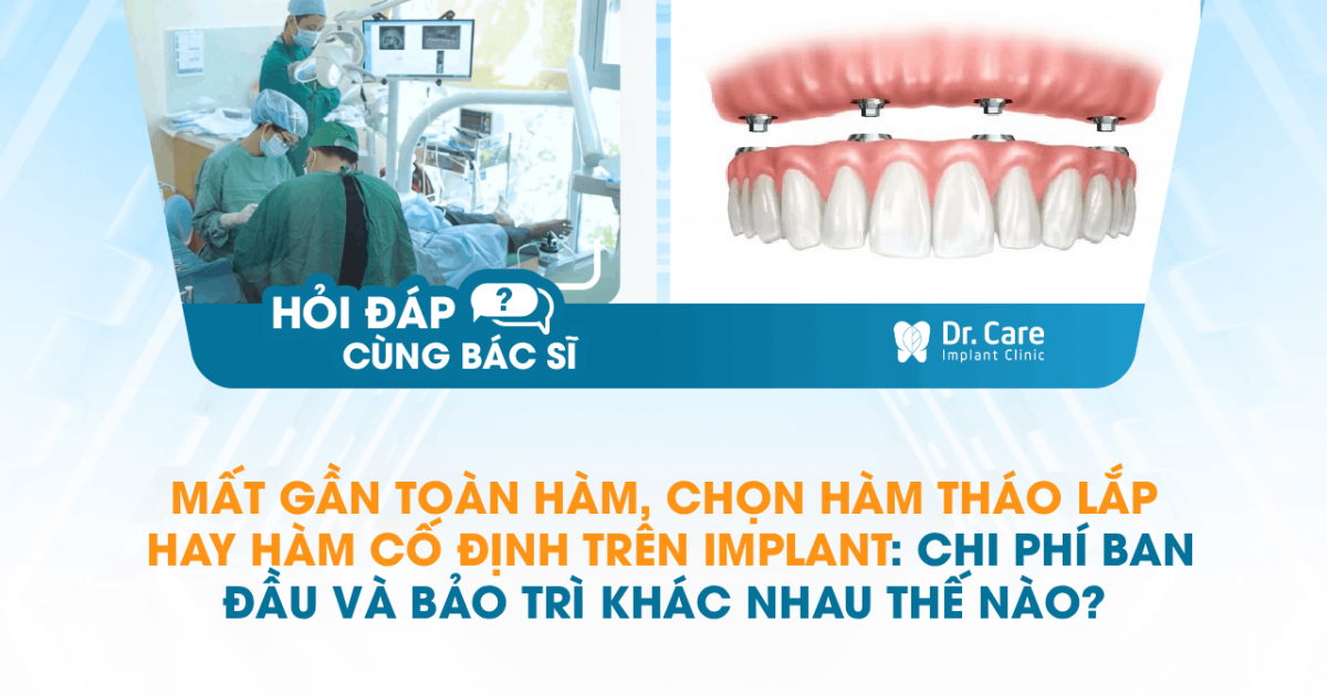 [Hỏi đáp bác sĩ] - Mất gần toàn hàm, chọn hàm tháo lắp hay hàm cố định trên Implant: chi phí ban đầu và bảo trì khác nhau thế nào?