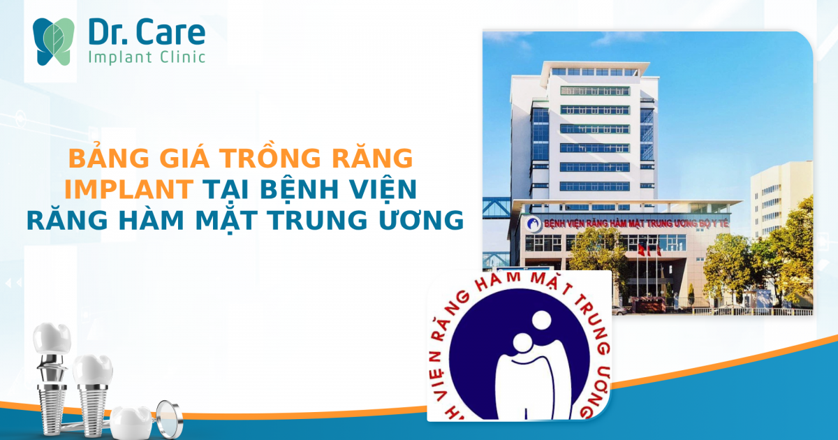 Bảng giá trồng răng Implant tại Bệnh viện Răng Hàm Mặt Trung Ương