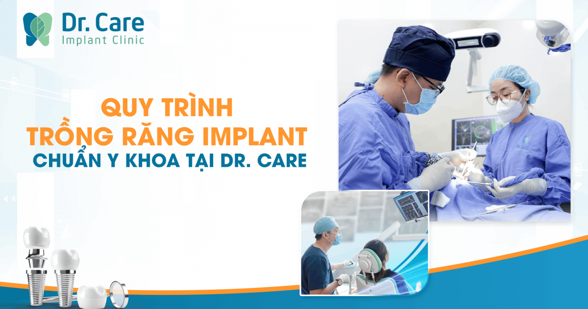 Quy trình trồng răng Implant chuẩn Y khoa tại Dr. Care